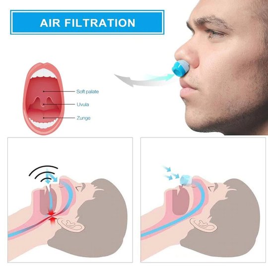 Electric Anti Snoring Device - 🔥BUY 2 GET 1 FREE